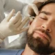 A professional skin treatment session involving cosmetic injectables, such as dermal fillers or neurotoxins, targeting facial rejuvenation.